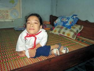 Gelukkig mag ze op de Mac Dinh Chi-school studeren, want anders moet ze elke dag gebracht en gehaald worden naar/van de enige school voor gehandicapten in Nha Trang (10km.