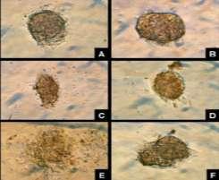 GLP-1 Preserved Morphology of Human Islet Cells In Vitro Control GLP-1 treated cells Day 1 Day 3 Islets treated with GLP-1 in culture were able to maintain their integrity for a longer period of time.