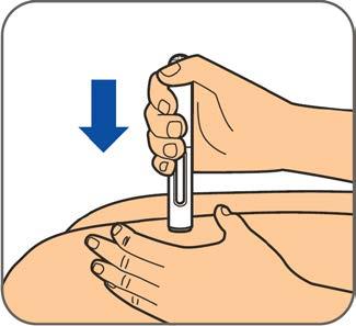 Nooit het dopje terug op de naald zetten. Stap 4: Rek de huid van de gereinigde injectieplaats zachtjes uit.
