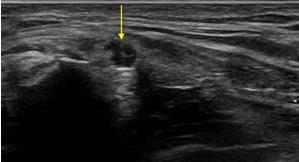 3. Beeldvorming: pathologie SIAS