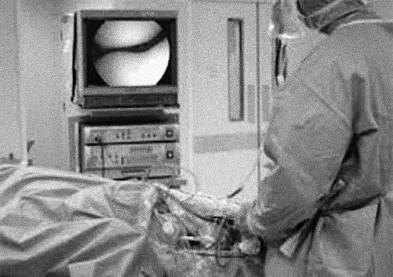 ARTHROSCOPIE WAT IS EEN ARTHROSCOPIE? Een kniearthroscopie is een zeer frequent uitgevoerde chirurgische ingreep waarbij er door middel van een kleine camera in het kniegewricht wordt gekeken.