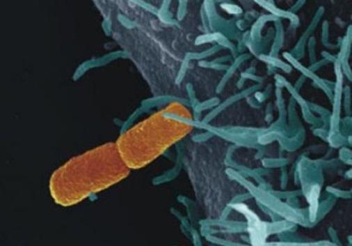 Links op foto: bacterie die rode loop (bloedige diarree) veroorzaakt 1779R Op