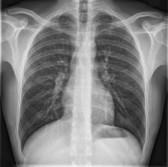 Pagina 4 van 22 Anatomie en Fysiologie De longen zijn de organen waarin gaswisseling plaatsvindt tussen lucht en bloed ten behoeve van de stofwisseling (metabolisme * ).