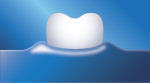 Natuurlijk wittere tanden Philips Sonicare-tandenborstel met Sensitive-poetsstand: poetsstand voor zachte, maar grondige reiniging van