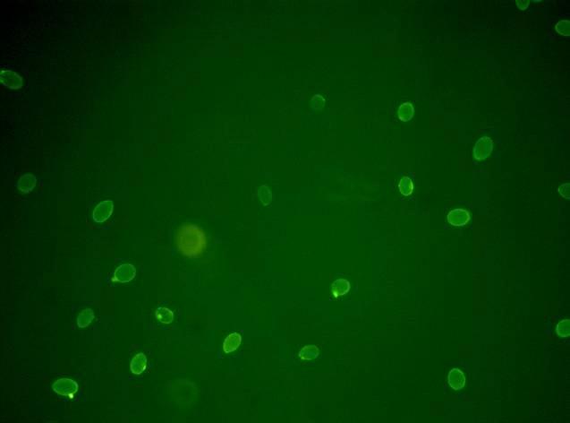 13 4. Flowcytometrie 4.1 Procedure Rozen die door A&F bij verschillende RV behandelingen in de uitbloeiruimtes werden bewaard, werden in een kleine hoeveelheid buffer afgespoeld.