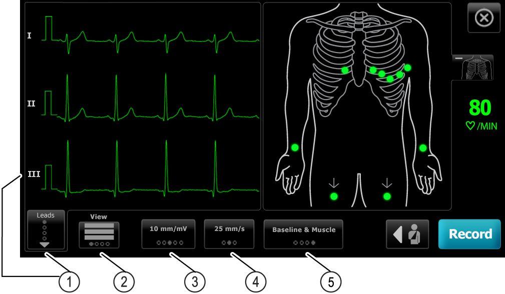 8 ECG-tests CP 150 Rust-elektrocardiograaf met 12 afleidingen Gewicht. Raak OK aan. Arts. Raak OK aan. Opmerkingen. Raak OK aan. 5. Breng de afleidingen aan op de patiënt. 6.