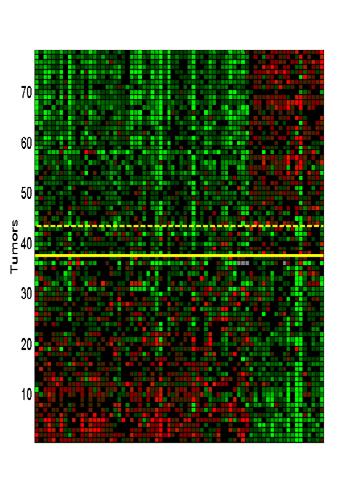 IMPROVED RISK ASSESSMENT OF EARLY BREAST CANCER THROUGH GENE EXPRESSION