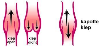 Inleiding. Welkom op de dienst vaatheelkunde. Bij u werden aan één of beide benen spataders vastgesteld die best kunnen verholpen worden met sclerotherapie.