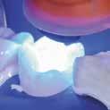 SEM-afbeelding van een CERASMART-restauratie (A) gehecht aan dentine (D) met behulp van G-Premio BOND (C) en G-CEM LinkForce (B) Bron: GC R&D, Japan Probeer de