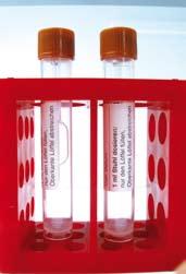 Voornaamste verwezenlijkingen in 2007 Publicatie van de klinische prestaties van onze vier innovatieve tests voor kankerdiagnose : Bloedtest voor screening op dikkedarmkanker Stoelgangtest voor