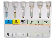 Introduction Introduction type & screen in UZA Reduce number of crossmatching Preoperative reservation of blood units in line with time-out procedure Small pilot study revealed