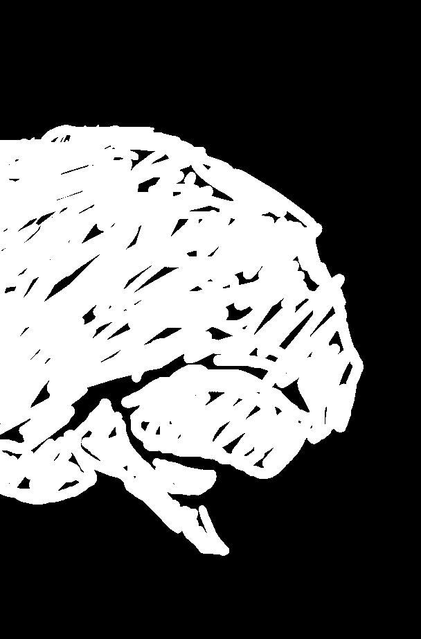 D. (2016). Brain, 139, 1551-1567. DOI: 10.1093/brain/aww027 5. MRI visual rating scales in the diagnosis of dementia: evaluation in 184 post-mortem confirmed cases. Harper, L., Fumagalli, G.