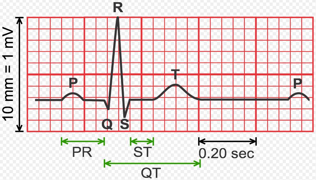 De elektrische activatie van het hart kan worden gemeten middels een ECG. De elektrische activatie van het hart begint met de depolarisatie van de SA-knoop, hier te zien als de P-top.