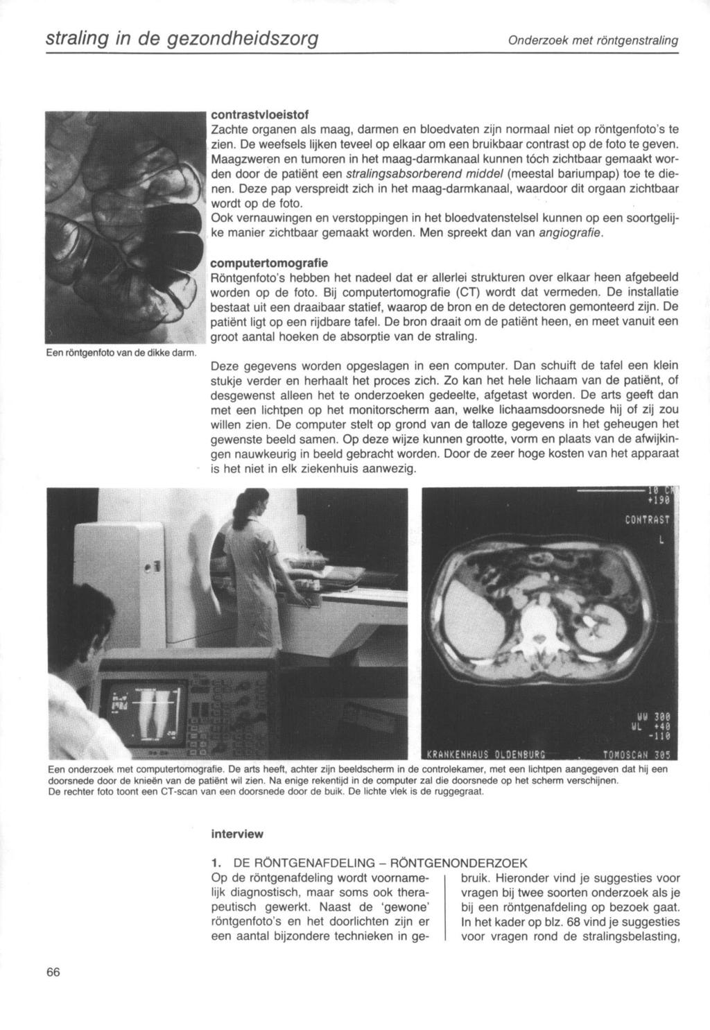 straling in de gezondheidszorg Onderzoek met röntgenstraling contrastvloeistof Zachte organen als maag, darmen en bloedvaten zijn normaal niet op röntgenfoto's te zien.