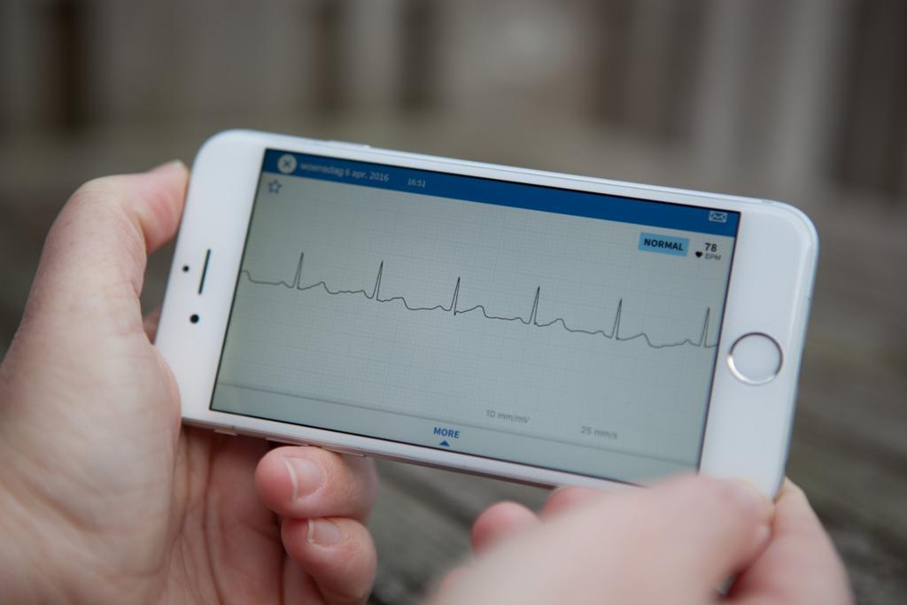 Livv zorg dichtbij 2 Hoe werkt Livv Mobiel ECG?