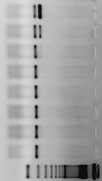 monster verd PCR 2 uitslag PCR 3 uitslag 1 onverdund + + 1 10x + + 1 100x ± ± 1 1000x -/± - 1 10 000x - - 1 100 000x - - 1 1 000 000x - - 1 10 000 000x - - marker 2 onverdund + 2 10x + 2 100x ± 2