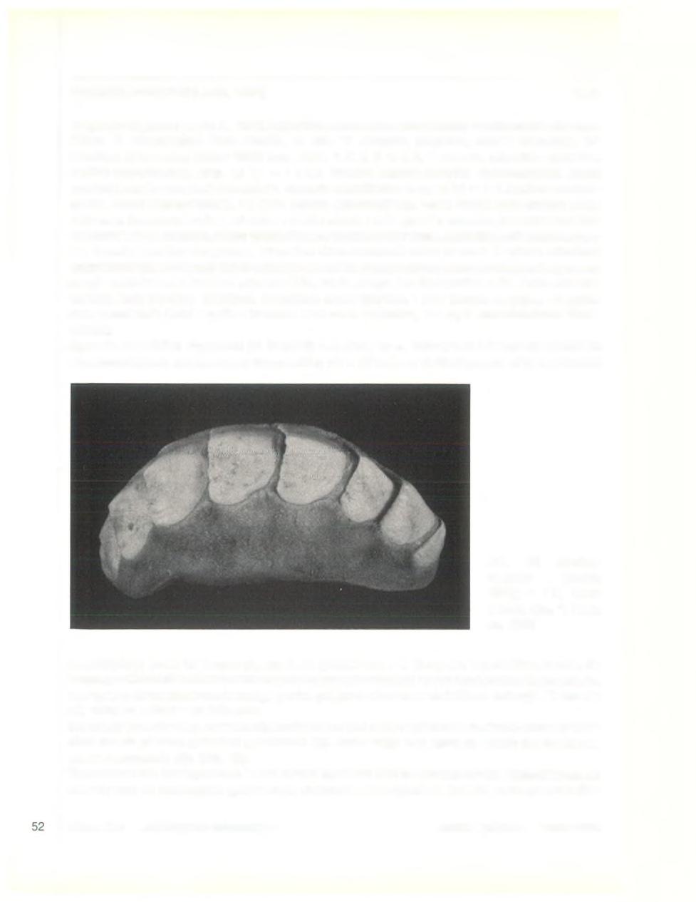 HANLEYA NAGELFAR (Lovén, 1846) 10.01 Originele diagnose: Lovén, S., 1846, Index Molluscorum litorascandinaviaeoccidentalia habitantum, Ofvers. K. Vetenskakad. Pörh. Stockh., 3: 158. "T.