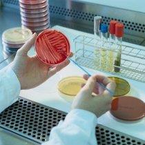 Huidige gebruik bacteriologisch onderzoek BO KM SKM Droog Vaak 34% 22% 7% Sporadisch 33% 21% 7%