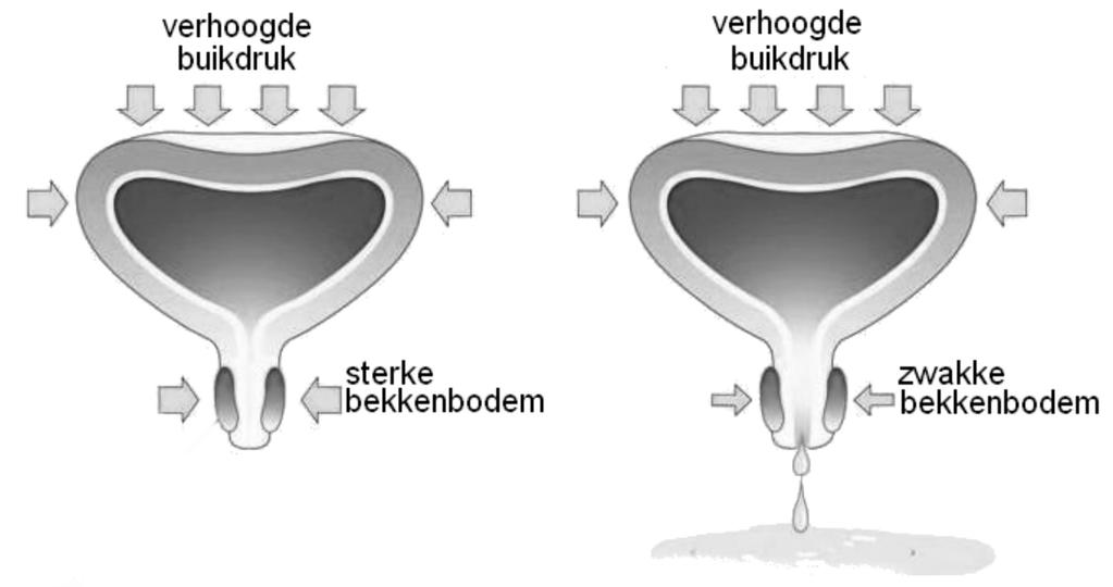 Adviezen voor buikdrukverlaging U bent bij de bekkenfysiotherapeut onder behandeling, omdat het voor u van belang is om de druk in uw buik zo laag mogelijk te houden.