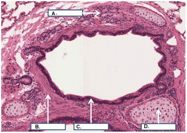 U ziet hier een histologisch preparaat van een onderdeel van de long. Plaats de onderdelen bij het juiste kader.