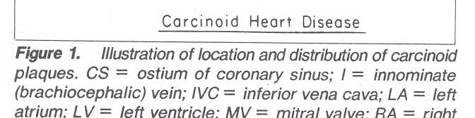 carcinoïd hartziekte hiervan: 90% TI +