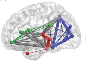 specifieke gebieden/cellen in de cortex die anatomisch van