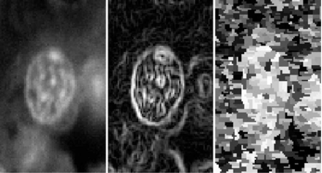 Vraag 6. (1 punt) Voor de segmentatie van een celkern in een fluorescentiebeeld (figuur 7(a) links), gebruiken we de watershed -methode.