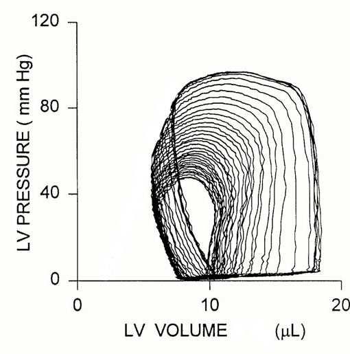 1. The figure below shows pressure-volume loops and aortic flow signals recorded in a mouse heart during vena cava constriction (Georgakopoulos et al, AJP 1998).