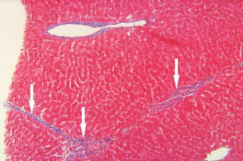 Figuur 4: Histologische coupe van een door cholangiohepatitis aangetaste lever (Trichome).