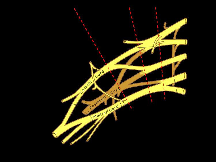 De plexus brachialis C5 T1 Specifieke indeling Wie tekent de fraaiste perifere zenuw