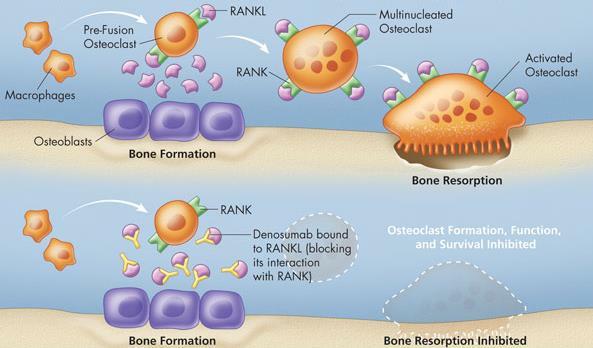 Denosumab: Receptor activator of nuclear