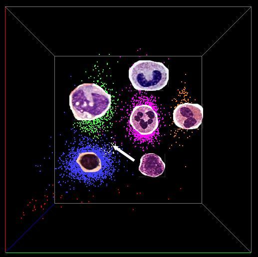 Hoofdprincipes: lichtverstrooiing & conductiviteit 3D-plot: Cell location and color coding: Lymphocytes (normal and many of the abnormals) are colored in Blue Monocytes (normal and many of the