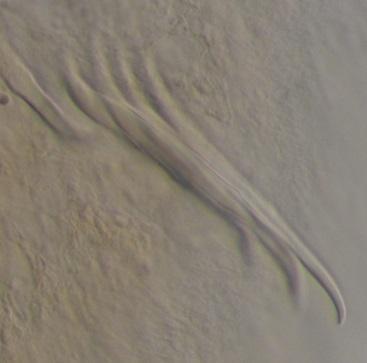 De soort heeft geen dorsale haarbundels. Kenmerkend is de afwezigheid van een dorsaal tandje op de ventrale borstels van segment 2.