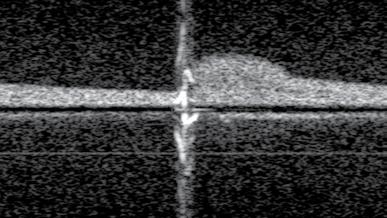 snelheid (cm/s) 18 16 14 12 1 8 6 4 2-2 -4-6 -8-1 -12-14 -16-18 verificatie spectrogram tijd (sec) 1 A Amplitude verificatie tijdreeks 5 1 15 2 25 3 35 4 45 5 55 6 65 7 75 8 85 9 tijd (msec) B Figuur