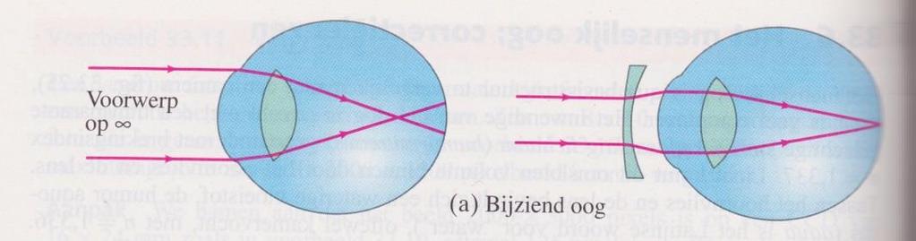 a) Welke lenssterkte zodat de persoon voorwerpen op oneindig kan zien? b) Wat is dan het Nabijheidspunt?