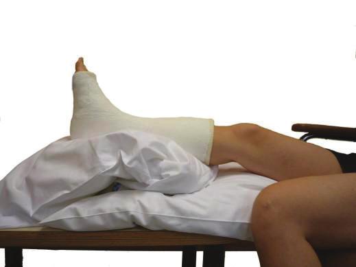 Infobrochure Gipsverbanden Waarom een gipsverband? Een gipsverband zorgt ervoor dat uw arm of been in het gips niet meer kan bewegen en zo voldoende rust krijgt.