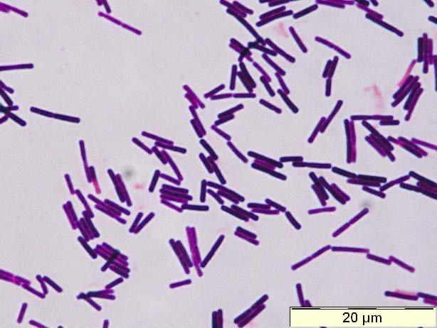 Inleiding Clostridium Difficile Anaerobe Sporulerende Grampositieve bacil Voornaamste oorzaak van