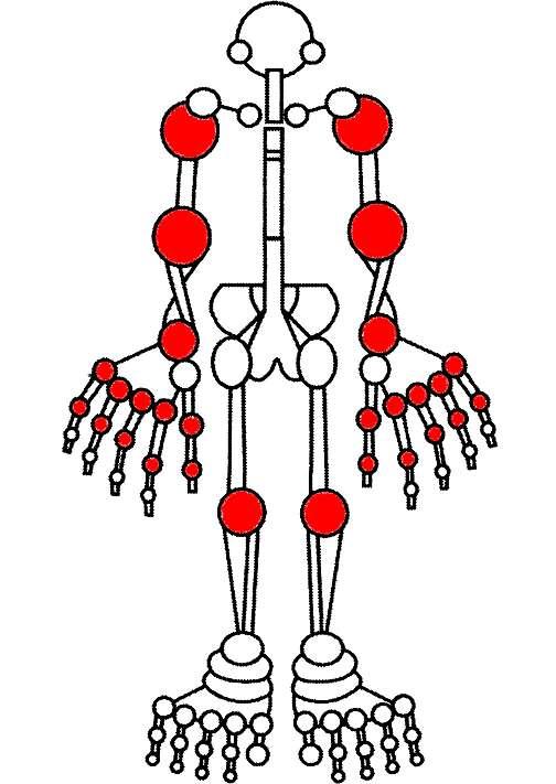 Groot aantal gewrichten Dit tekeningetje met 28 gewrichten wordt door de reumatologen gebruikt bij de berekening van de ziekte-activiteit van RA-patiënten.