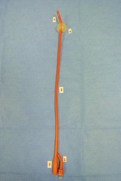 76 Hoofdstuk 2 Peroperatieve fase 2. Figuur 2.15 Foley-katheter met benamingen (1 t/m 5) 4. De ballon (of cuff) van de katheter. 5. De tip van de katheter is het uiteinde van de katheter.