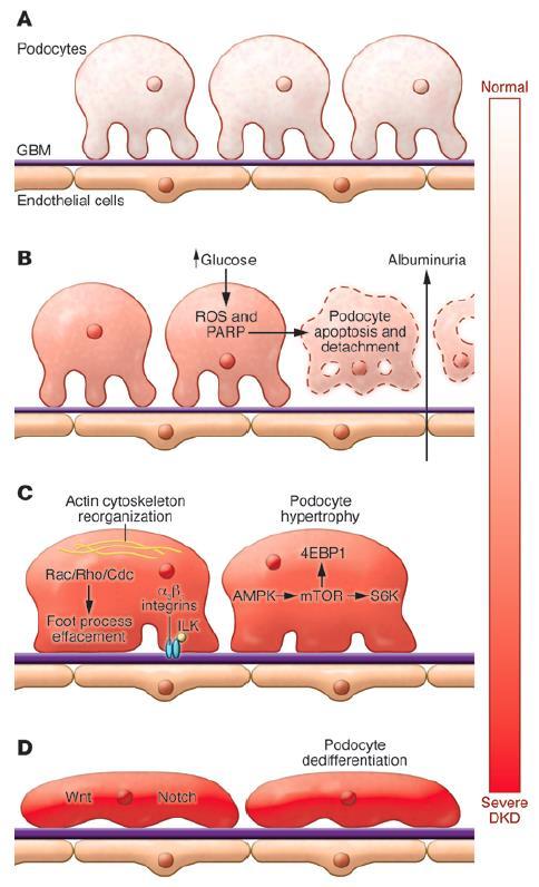 Podocyte weakest link Aantal podocyten correleert