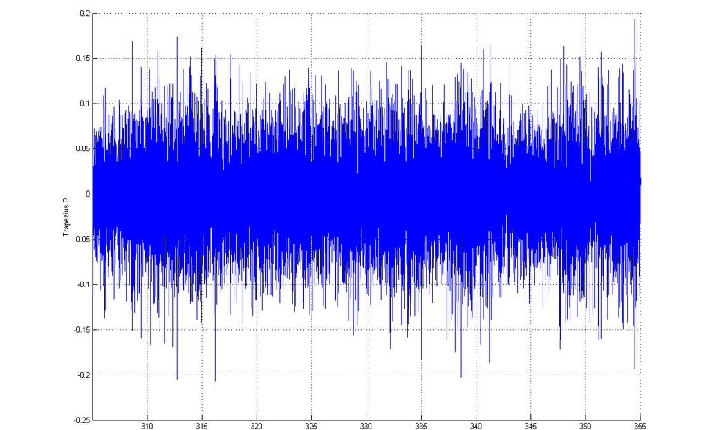 Wavelet-ICA: TS Spieren: niet zo gestructureerd qua opbouw als het hart Verdeling van