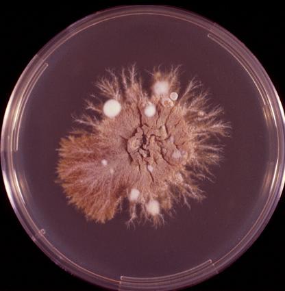 bruin centrum (zie Fig. 10). 2. : glad- en dunwandige macroconidia in clusters.