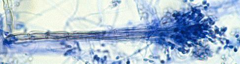 Scedosporium apiospermum: korte tot lange conidiofoor met conidia in groepjes of alleen voorkomend.