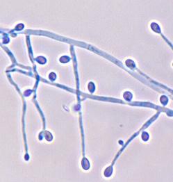 Pseudallescheria boydii: veel lichtbruine tot zwarte bolvormige cleistothecia; ronde ascus met 8 sporen; 1-cellige, citroenvormige, gladwandige ascosporen lichtgeel tot goudbruin van kleur (zie