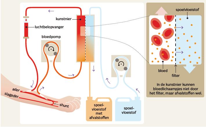 Om de procedure veilig te doen verlopen, beschikt het toestel over allerhande alarmen die toelaten de behandeling waar nodig bij te sturen.