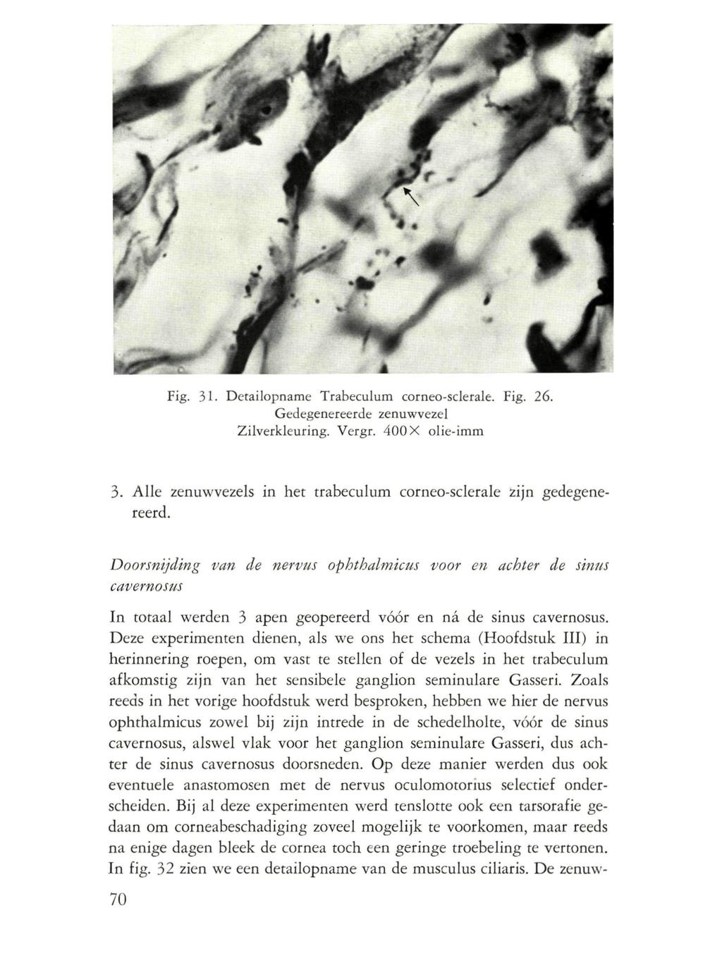 Fig. 31. Detailopname Trabeculum corneo-sclerale. Fig. 26. Gedegenereerde zenuwvezel Zilverkleuring. Vergr. 400 X olie-imm 3. Alle zenuwvezels in het trabeculum corneo-sclerale zijn gedegenereerd.