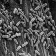 prokaryoten eukaryoten afmetingen (in µm) plasma-membraan interne membraansystem eiwitsynthese DNA kern ribosomen 5.