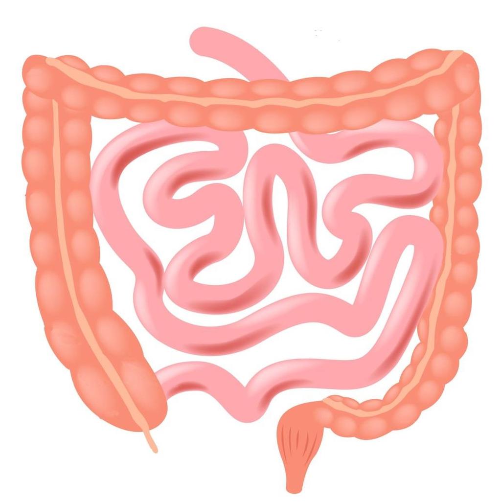 Afbeelding 2: uw situatie (*) Een stoma Bij een stoma wordt het uiteinde van de darm gehecht in de buikwand. Dit wordt een enkelloops stoma genoemd.