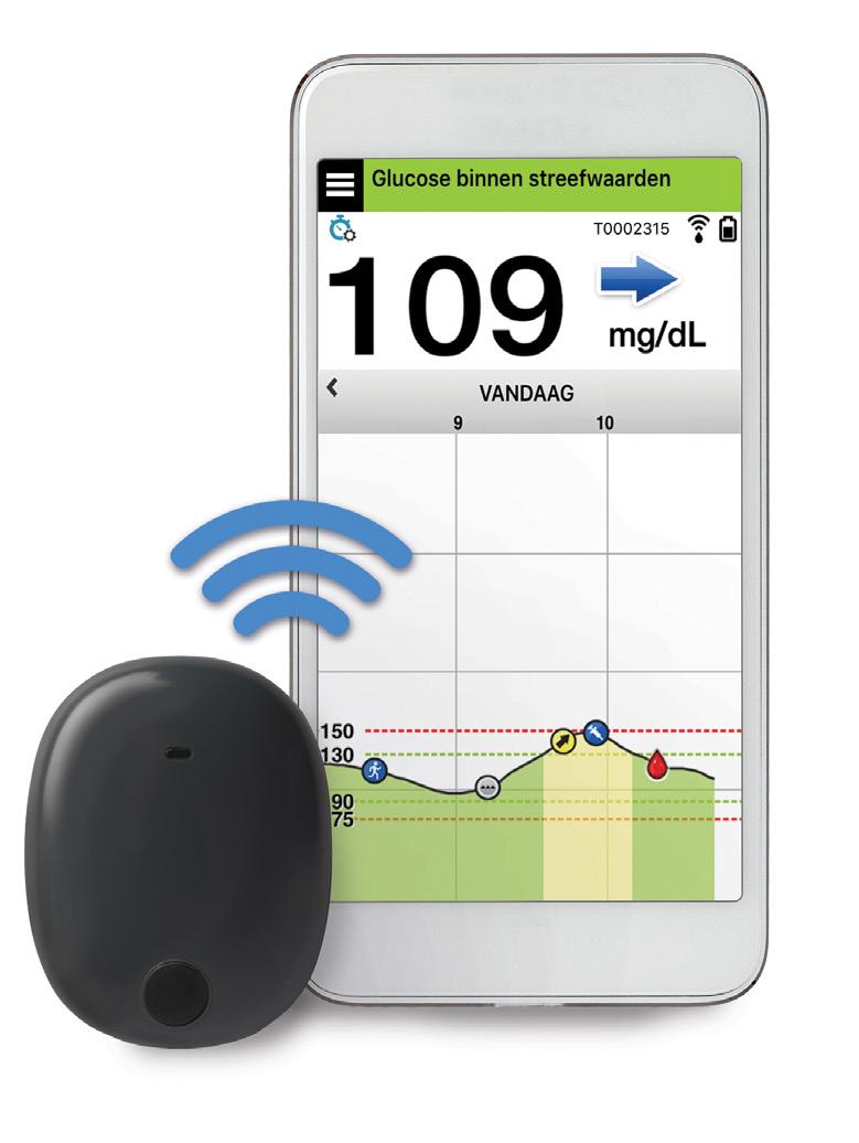 Beknopte handleiding Uw Eversense CGM-systeem omvat een sensor die in uw bovenarm wordt ingebracht, een Smart-zender die over de sensor heen wordt gedragen en een app voor mobiele apparaten