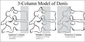 Termen Burstfractuur Dekplaat/ Sluitplaat Voorste/ middelste/ achterste pijler Achterste complex Inzakking Osteoporose Stabiel/ instabiel Brace/ gipskorset Spondylodese Classificaties Wervelfractuur